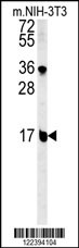BLOC1S2 Antibody
