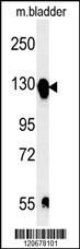 ITGA5 Antibody