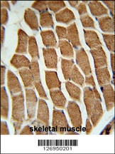 CTTNBP2 Antibody