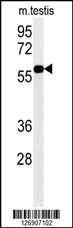 DKC1 Antibody