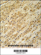 DKC1 Antibody