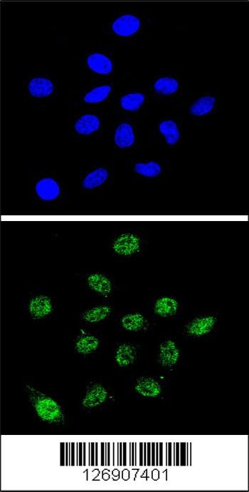 DKC1 Antibody