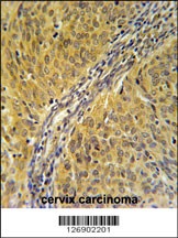 DYNC1LI2 Antibody