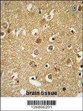 RAB11FIP2 Antibody