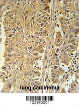 PGD Antibody