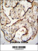 EGFR-S1026 Antibody