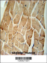 CRLS1 Antibody