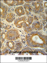 CRABP1 Antibody