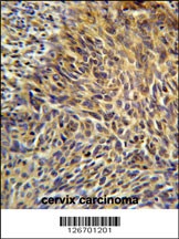 ANKRD32 Antibody