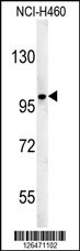 ST18 Antibody