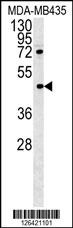 PYHIN1 Antibody