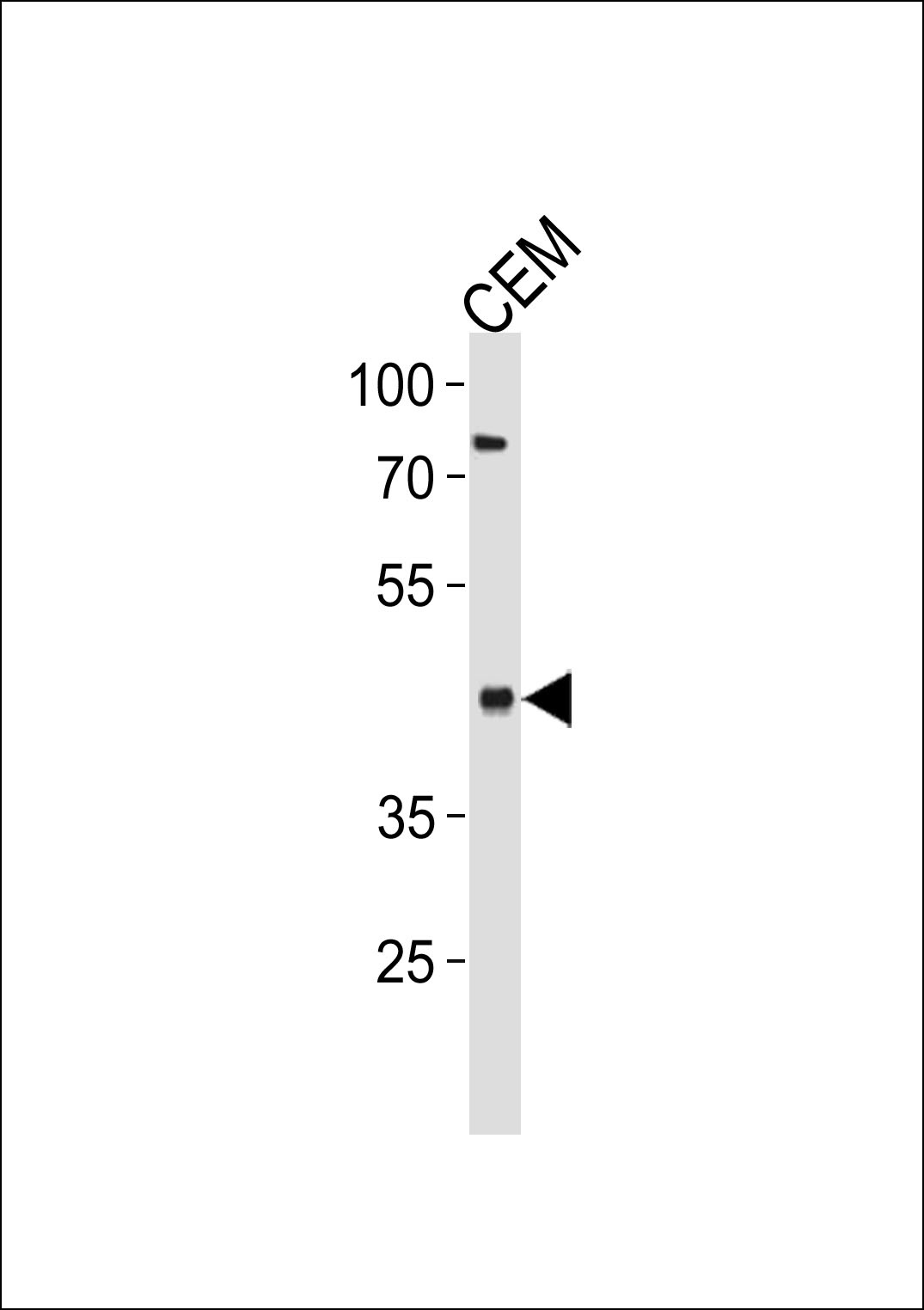 FADS2 Antibody