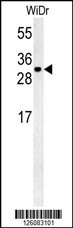 TM2D3 Antibody