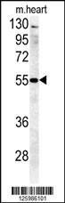 B4GALT5 Antibody
