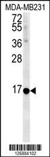 NMB Antibody