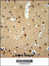 NMB Antibody