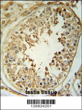 CPNE8 Antibody