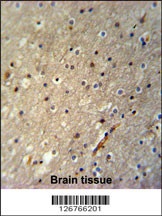 ACTL6B Antibody