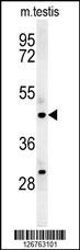 STAMBPL1 Antibody