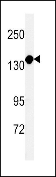 MTMR15 Antibody