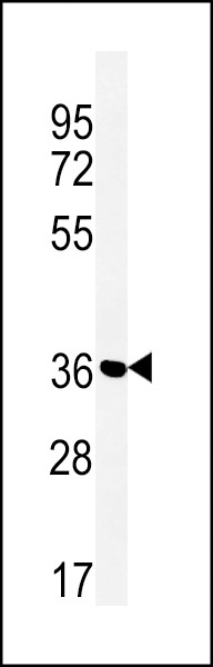 SLC25A28 Antibody