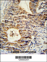 KLHL24 Antibody