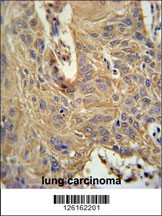 IL5RA Antibody