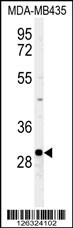 FBXL15 Antibody