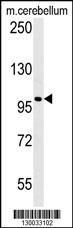 EPC2 Antibody