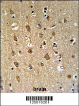 ENPP6 Antibody