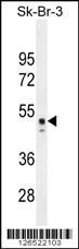 CNOT6L Antibody