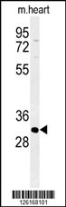 ATP4B Antibody