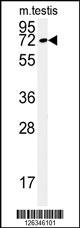 KLHL9 Antibody