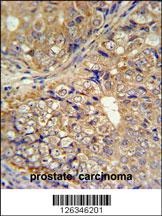 KLHL9 Antibody