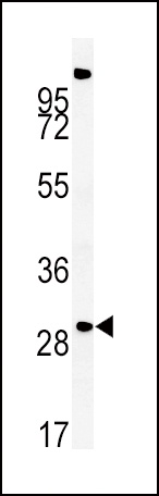 ZDHHC21 Antibody