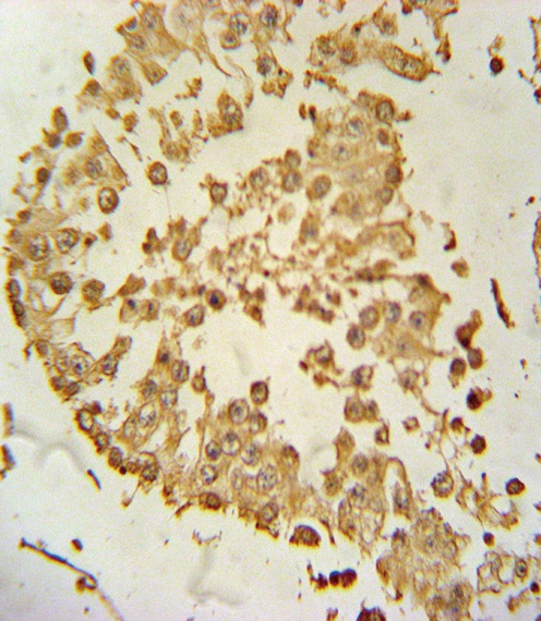 ZDHHC21 Antibody