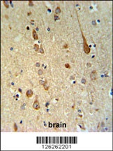 FAAH2 Antibody