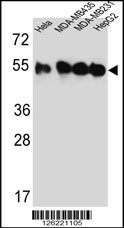 TUBB4B Antibody