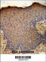 CXCL9 Antibody