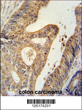 BTG1 Antibody