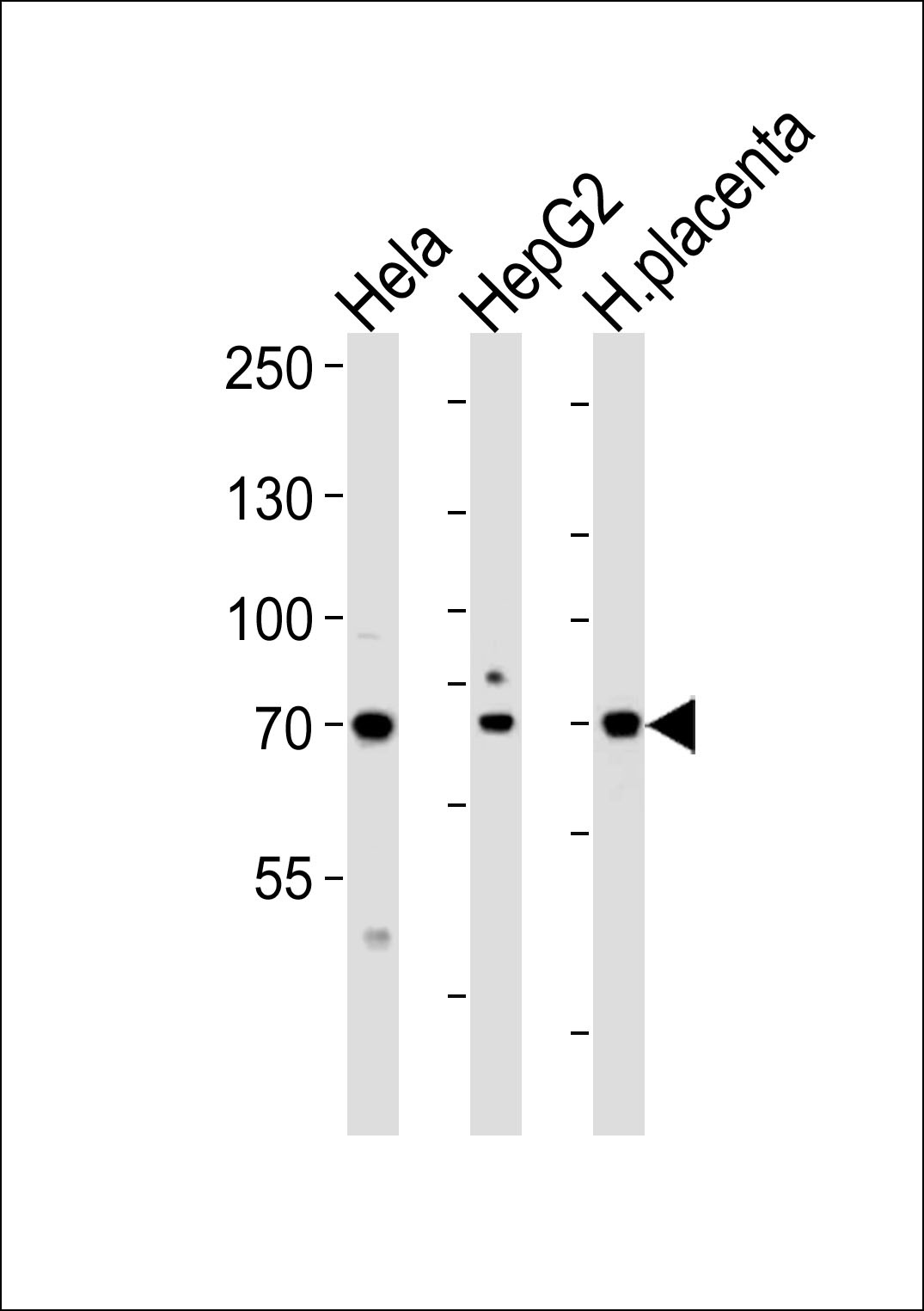 ATF6B Antibody