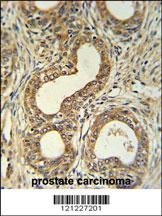 Roundabout 4 Antibody
