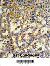 G6PD Antibody