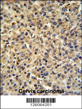 TPRGL Antibody
