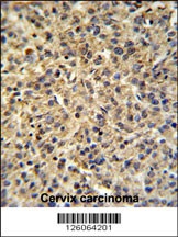 TPRG1L Antibody