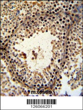 PHF13 Antibody