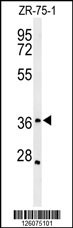 MIIP Antibody