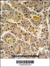 INO80D Antibody