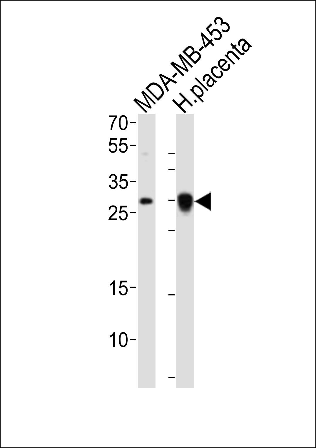 FOLR2 Antibody