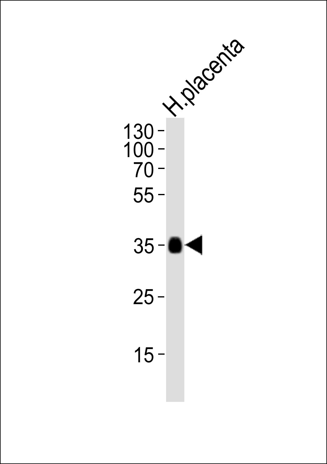 FOLR2 Antibody